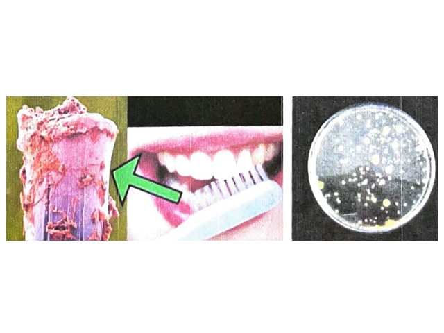 同じ歯ブラシを長い間使い続ける事の弊害とは？